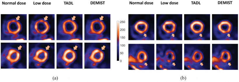 New article on detection-task specific deep denoising